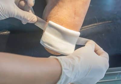 Medical treatment for dog bite injury in Georgia